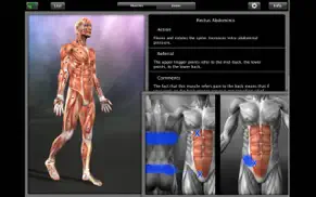 muscle trigger point anatomy iphone capturas de pantalla 4