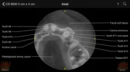 cbct iphone images 3