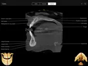 cbct ipad images 4