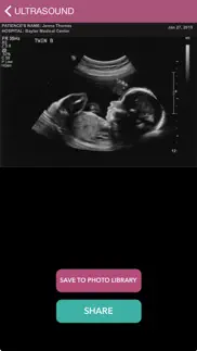 baby ultrasound 2015 iphone images 1