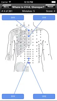 acupuncture points body quiz iphone images 2