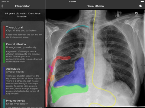 realworld radiology ipad resimleri 1