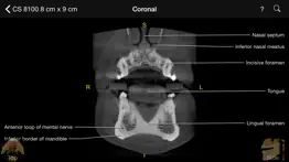 cbct iphone images 2