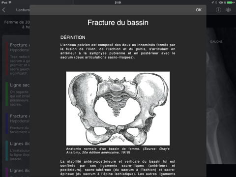 realworld orthopaedics iPad Captures Décran 4