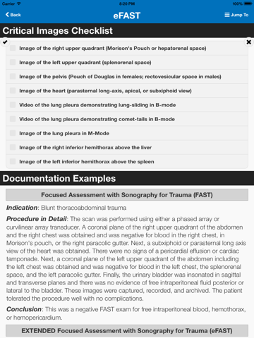 sonosupport: a clinical emergency medicine and critical care ultrasound reference tool ipad images 3