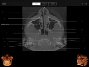 cbct ipad images 3