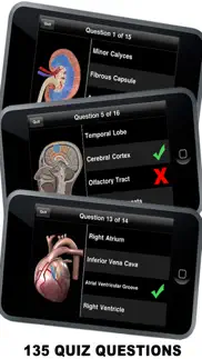 anatomy 3d - organs iphone bildschirmfoto 3