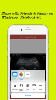 baby ultrasound spoof iphone images 3