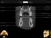 cbct ipad images 1