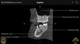 cbct iphone images 1