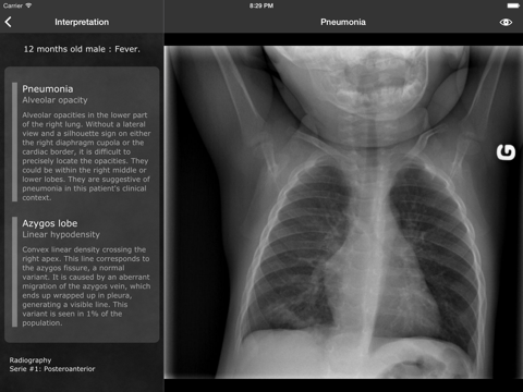 realworld radiology ipad resimleri 3