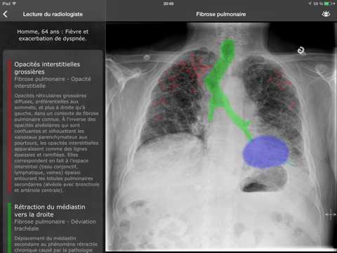 realworld radiology iPad Captures Décran 4