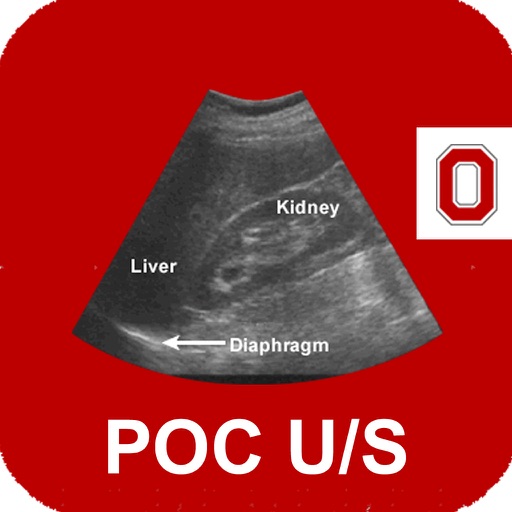 POC Ultrasound Guide app reviews download
