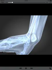 orthopaedics - understanding disease ipad images 4