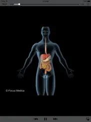 gastroenterology - understanding disease ipad images 4