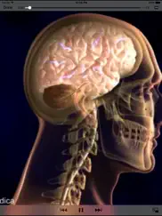 neurology - understanding disease ipad images 4