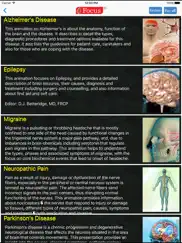 neurology - understanding disease ipad images 2