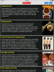 orthopaedics - understanding disease ipad images 2