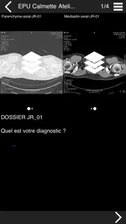 cours tdm multicoupe du thorax iphone images 2