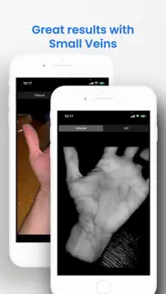 veinseek pro iphone capturas de pantalla 4
