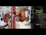 insight kidney enterprise ipad resimleri 1