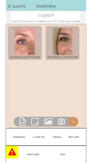 eye2eye pro iphone images 3