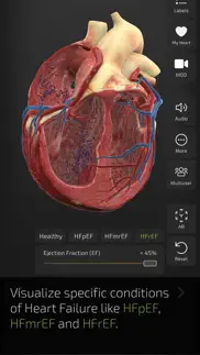 insight heart iphone resimleri 4