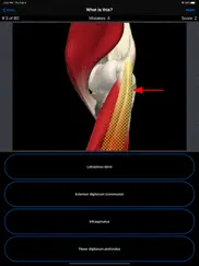 anatomy shoulder quiz iPad Captures Décran 4