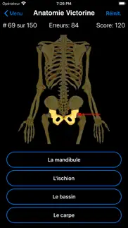 anatomie victorine iPhone Captures Décran 3
