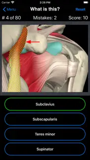 anatomy shoulder quiz iPhone Captures Décran 3