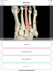 anatomy foot quiz iPad Captures Décran 4