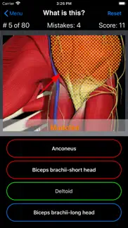 anatomy shoulder quiz iPhone Captures Décran 4