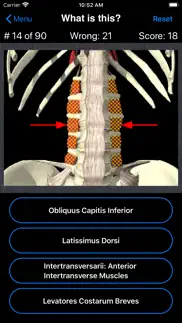 anatomy spine quiz iPhone Captures Décran 2