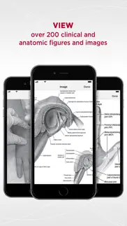 5 minute sports med consult iphone images 2