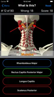 anatomy spine quiz iPhone Captures Décran 4