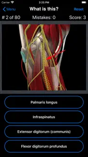anatomy shoulder quiz iPhone Captures Décran 2