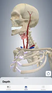 3d cervical dystonia iphone images 2