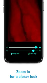 veinscanner pro iPhone Captures Décran 4