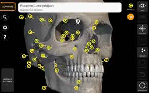squelette anatomie 3d iPhone Captures Décran 1