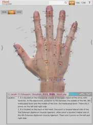 hand acupuncture ipad resimleri 1
