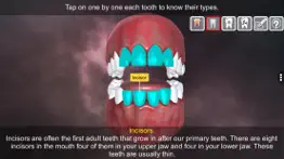 incredible human teeth iphone images 4