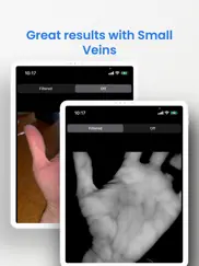 veinseek pro iPad Captures Décran 4