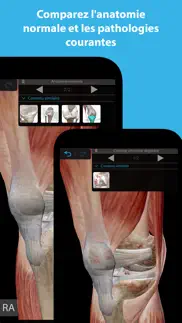 muscles & kinésiologie iPhone Captures Décran 2