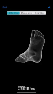 3dfootscan iphone images 2