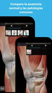músculos & kinesiología iphone capturas de pantalla 2