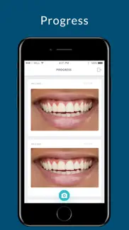 bites dental iphone images 2