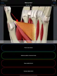 anatomy hand quiz ipad bildschirmfoto 4