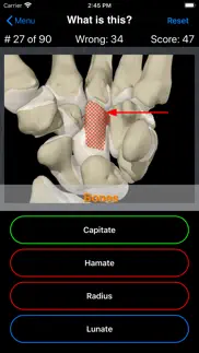 anatomy hand quiz iphone bildschirmfoto 4