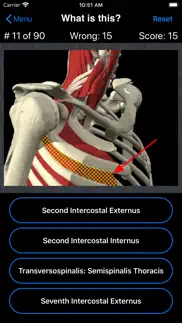 anatomy spine quiz iPhone Captures Décran 3