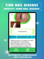 find nail disease ipad resimleri 3